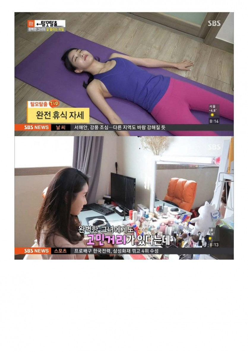 탈모가 걱정인 모델_