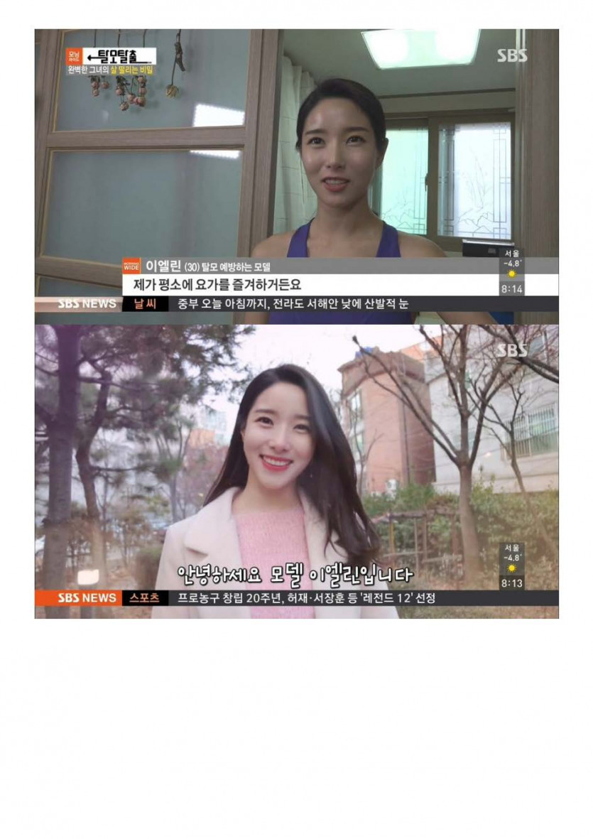 탈모가 걱정인 모델_