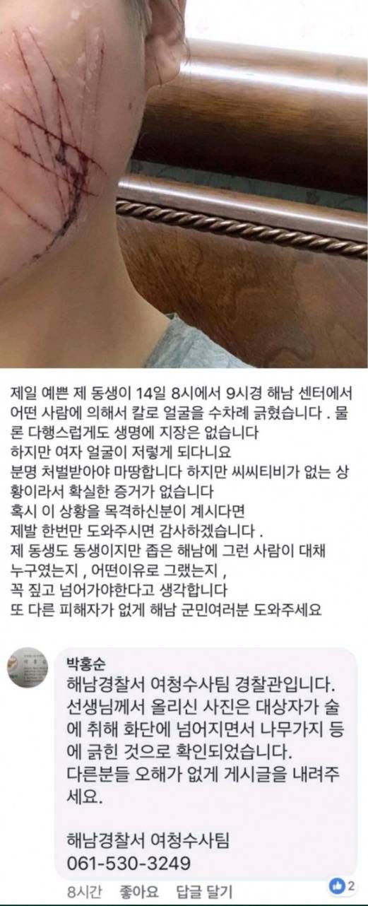 혐주의) 해외 토픽까지 갔었던 여자라서 당한일