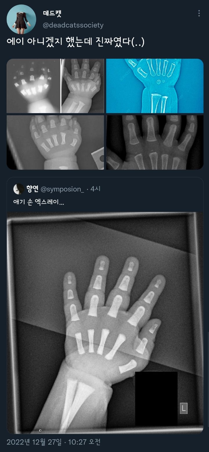 아기들이 통통한 이유