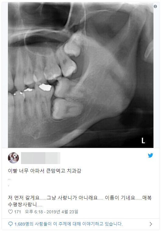 혐주의) 이빨이 너무 아파 치과에 간 결과