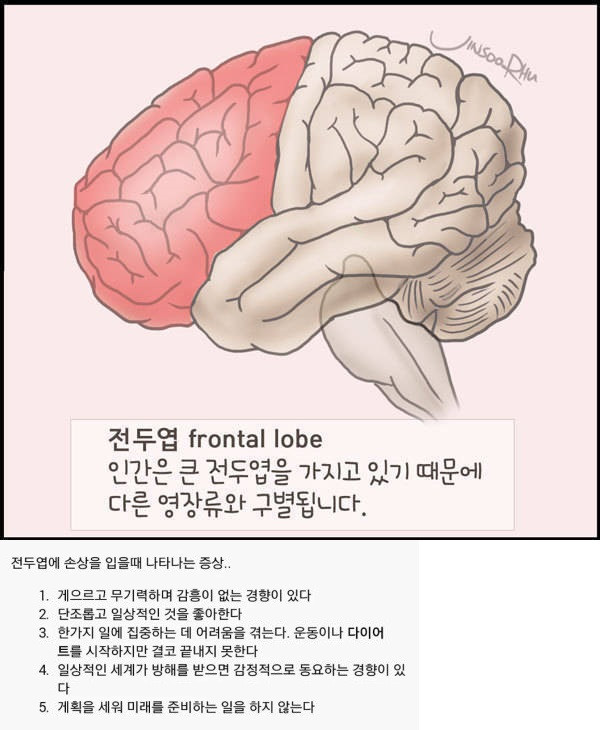 전두엽 손상시 나타나는 증상들.