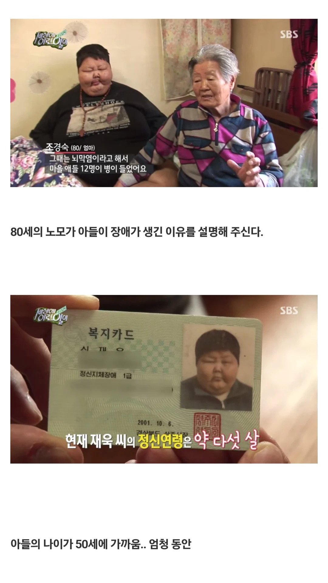 세상에 이런일이 초고도비만 아들