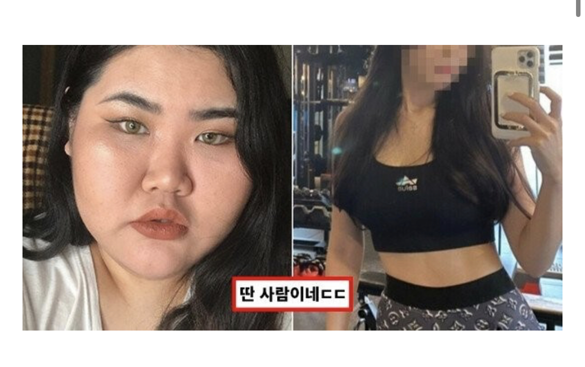 배리나 70kg 감량 사진의 진실