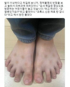 요즘 유행하는 피부병