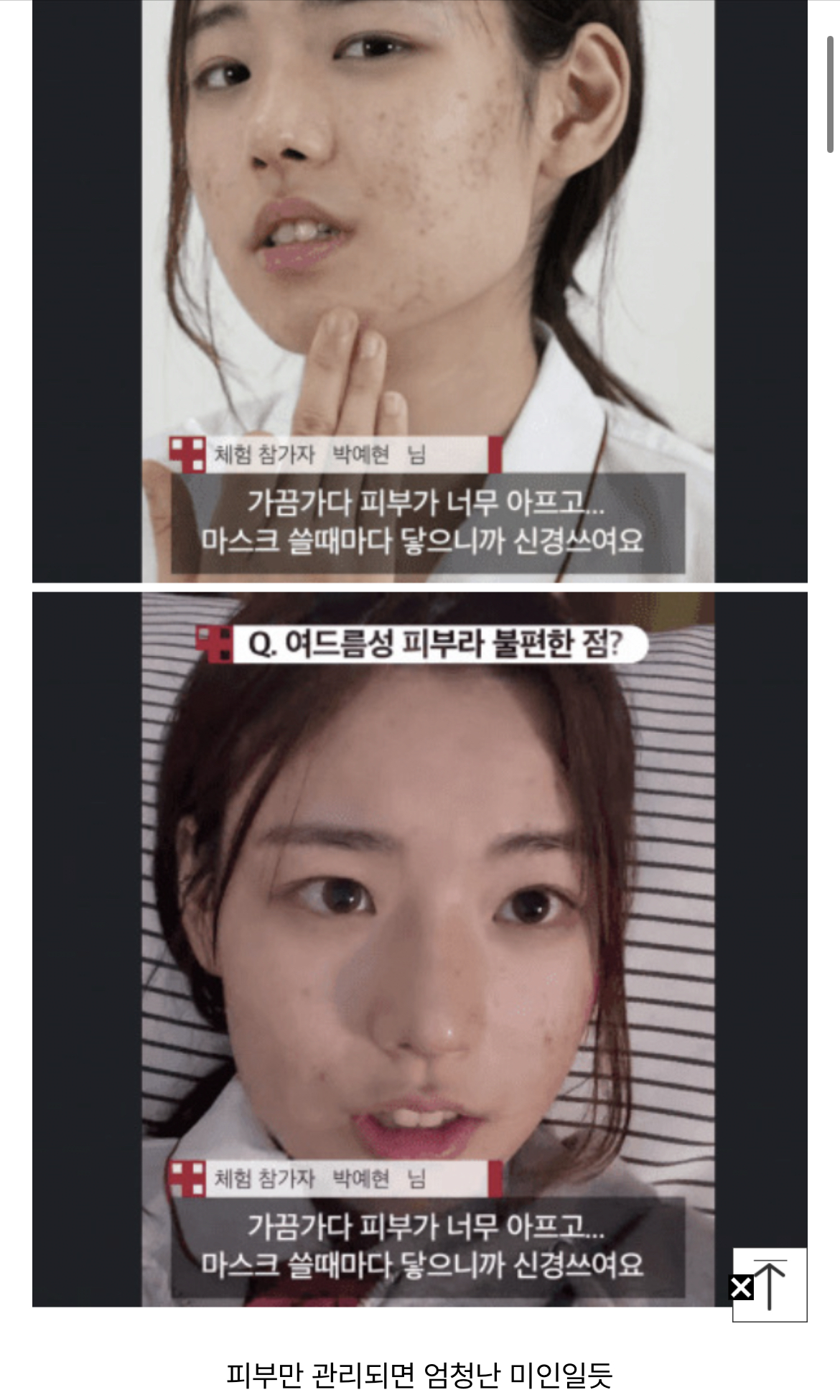 여드름있는 여고생 쌩얼