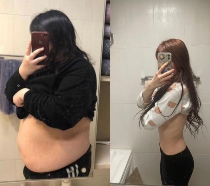 무려 70kg 다이어트 성공했다는 여자 ㄷㄷ