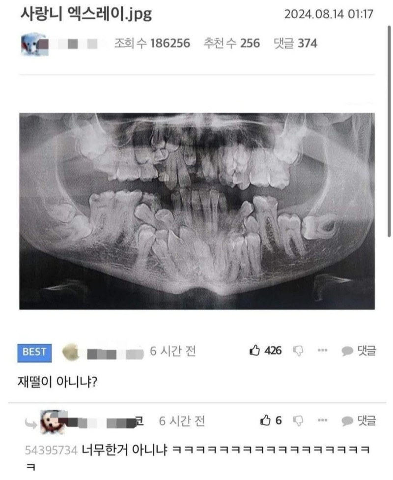 재떨이아니냐ㅋㄱㄱㅋ