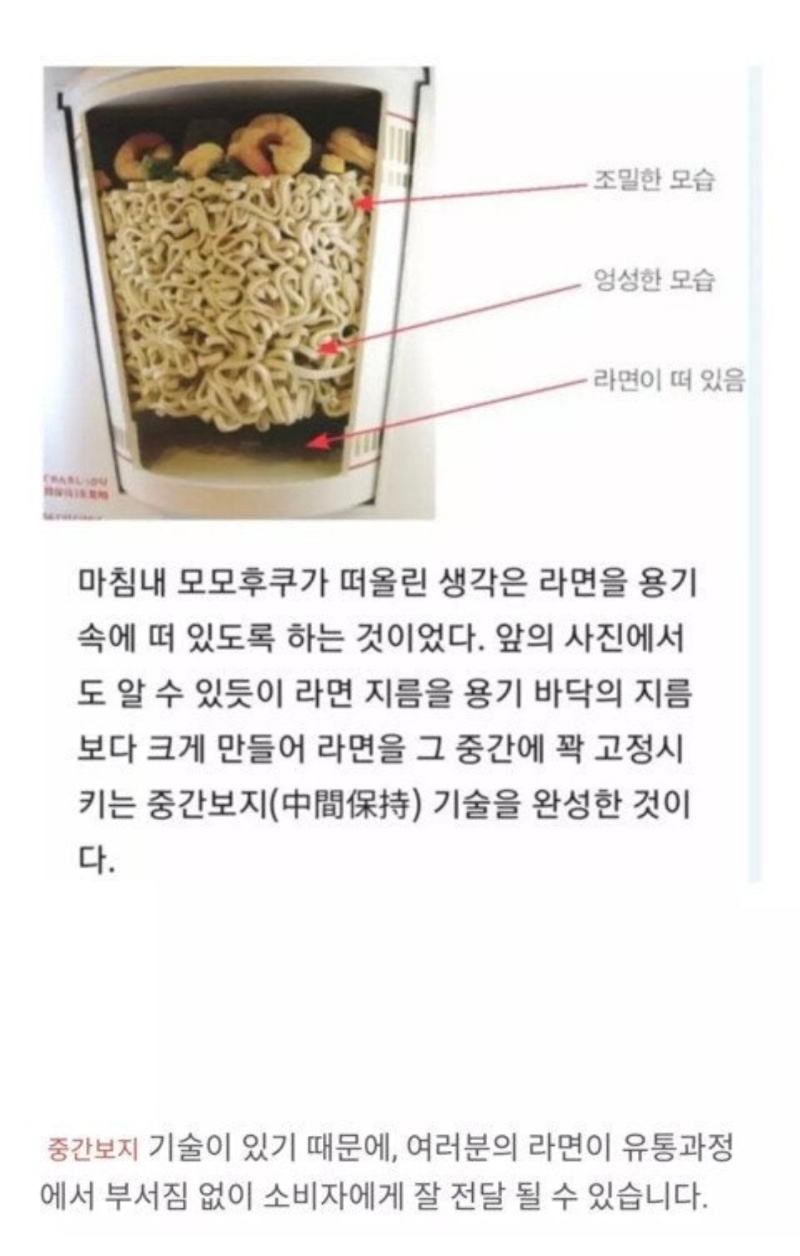 중간보지 기술이란