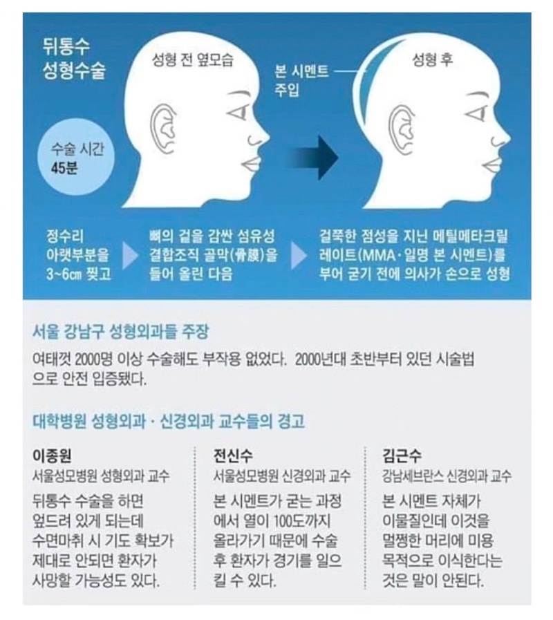 무시무시한 요즘 성형수술 수준