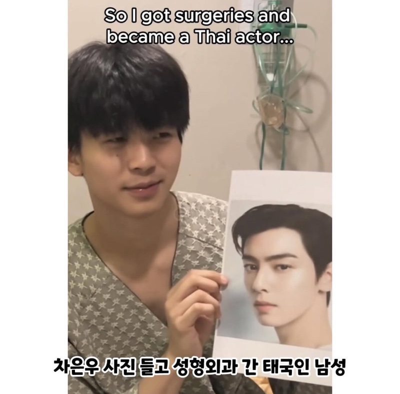 차은우 처럼 성형한 태국인 결과