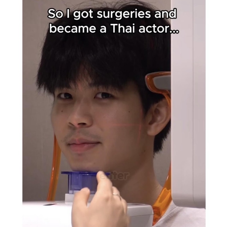 차은우 처럼 성형한 태국인 결과