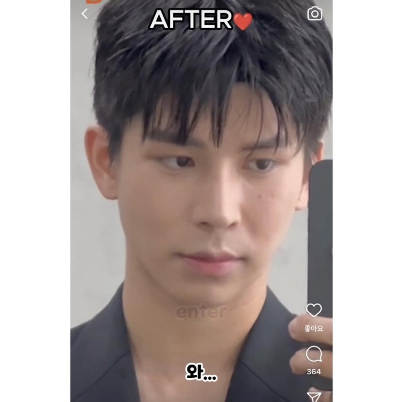 차은우 처럼 성형한 태국인 결과