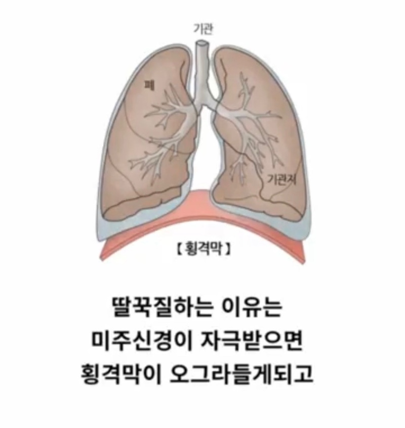 딸국질 1초만에 멈추는 꿀팁