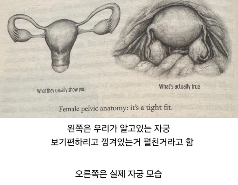 자궁의 실제 모습