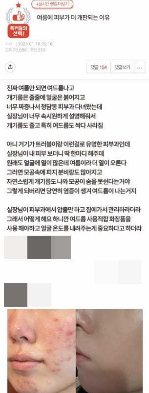 여름에 알고 있으면 무조건 도움됨