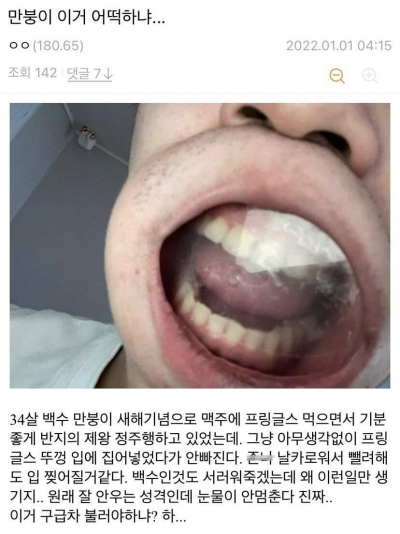프링글스 뚜껑 입에낀