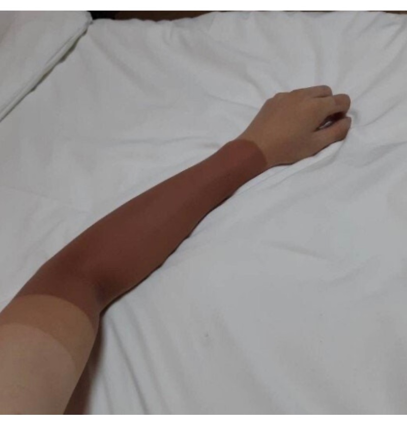 자전거 7년차 팔뚝