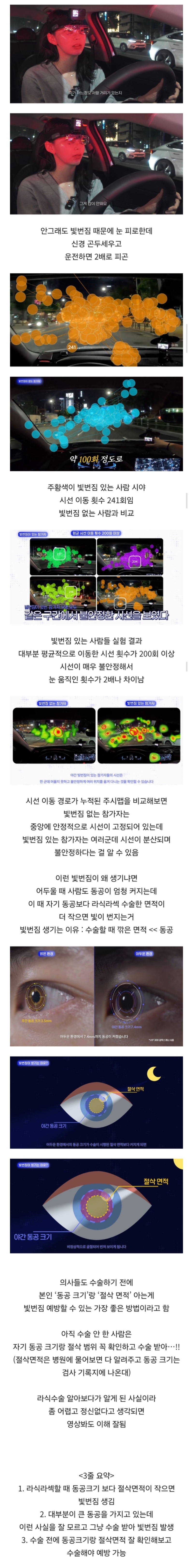 라식한 사람들이 겪는 부작용 1위