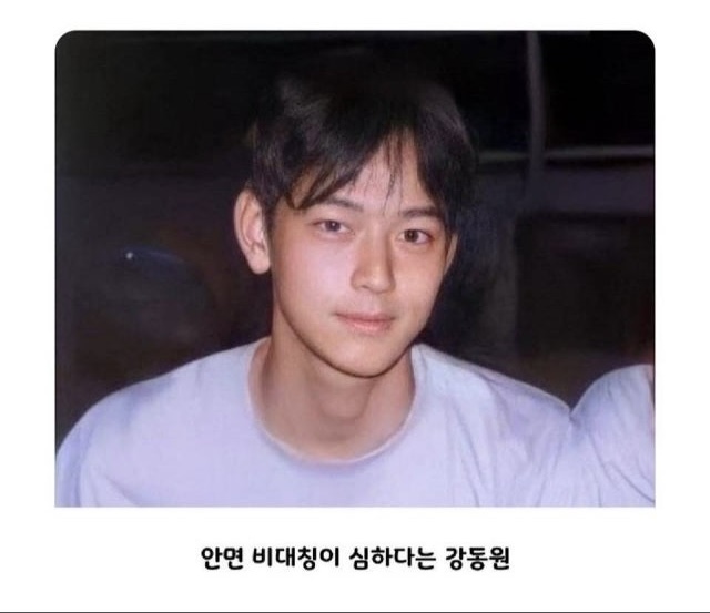 안면 비대칭 신경 안 써도 됩니다