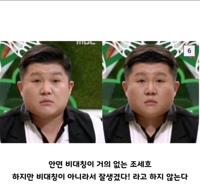 안면 비대칭 신경 안 써도 됩니다