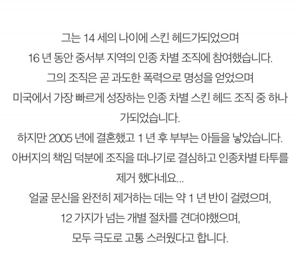 아버지가 되자 얼굴 문신을 제거한 범죄자